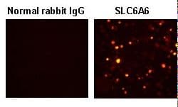 Polyclonal Rabbit anti-Human SLC6A6 / Taurine Transporter Antibody (IHC)
