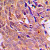 CHEK1 / CHK1 Antibody (Internal)