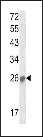 SOCS1 Antibody (aa35-66)