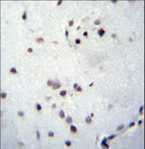 ZNF417 Antibody (aa136-164)