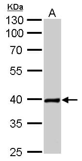 Polyclonal Rabbit anti-Human NKX2-5 Antibody (aa1-218, WB)