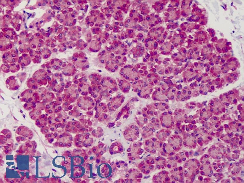 IHC-plus™ SLIT1 Antibody
