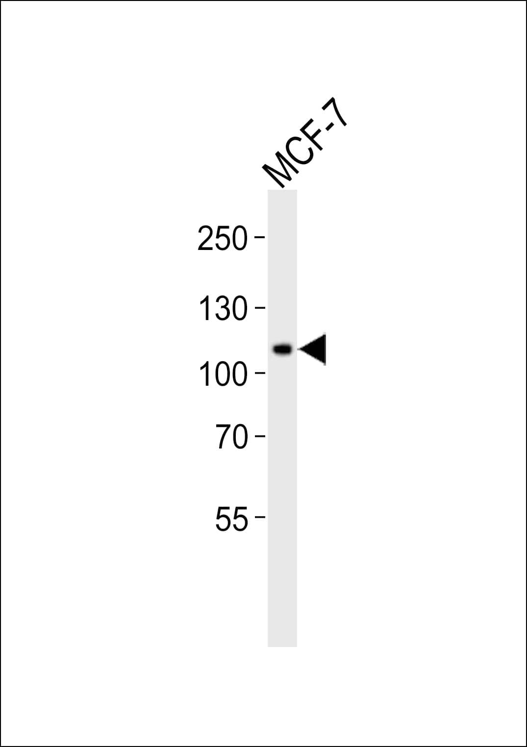 RHBDF2 Antibody (aa80-109)