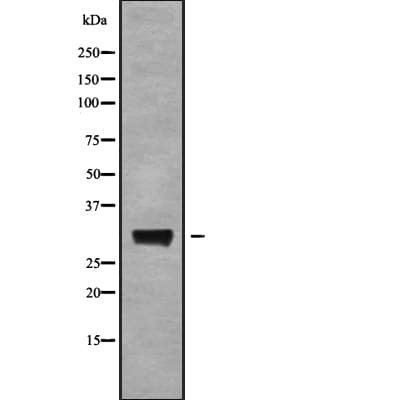 AQP6 / Aquaporin 6 Antibody