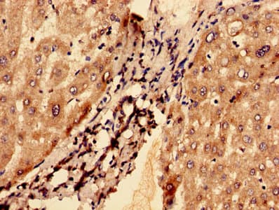 G0S2 Antibody (aa1-103)