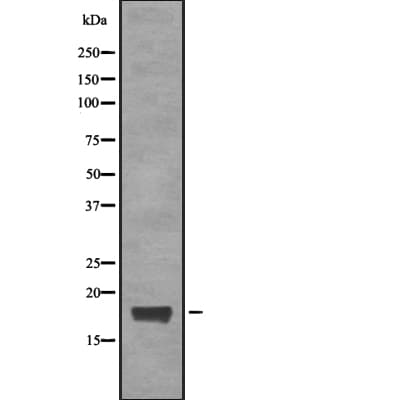 CGGBP1 Antibody