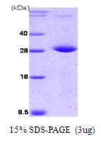 Human PPM1G Protein (Recombinant His)