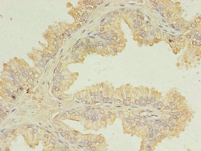 UBE2D1 / UBCH5 Antibody