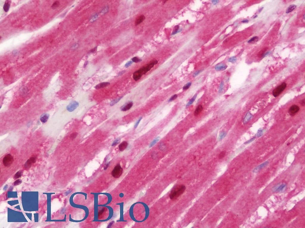 IHC-plus™ Polyclonal Rabbit anti-Human HSPA6 / HSP70B' Antibody (aa377-628, IHC, WB)