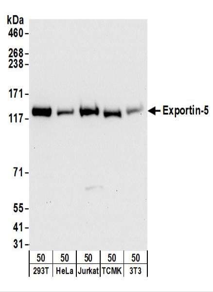 IHC-plus™ XPO5 / Exportin 5 Antibody (aa1154-1204)