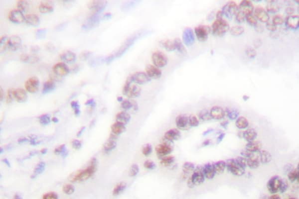 NR1A2 / THRB Antibody (Leu37)