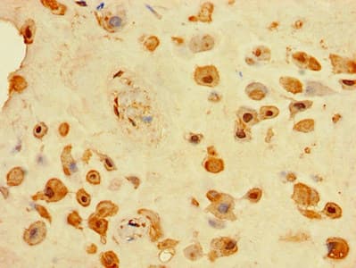 Polyclonal Rabbit anti-Human TINAGL1 / Lipocalin 7 Antibody