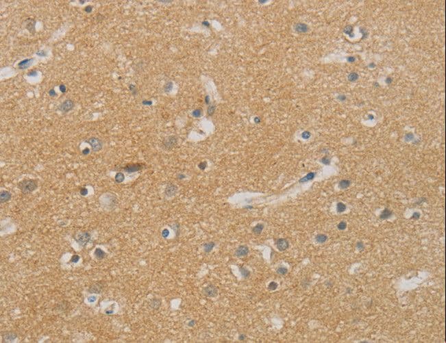 Polyclonal Rabbit anti-Human NDRG1 Antibody (IHC, WB)