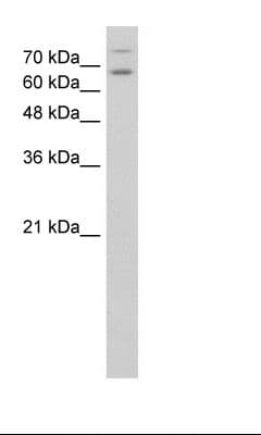 TSH Receptor / TSHR Antibody (aa251-300, HRP)