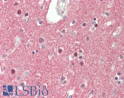 SV2A / SV Antibody (aa501-550)