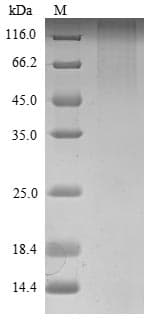 Mouse ROBO1 Protein (Recombinant 6His, N-terminus)