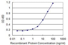 Monoclonal Mouse anti-Human HDAC8 Antibody (clone 2F4, WB)