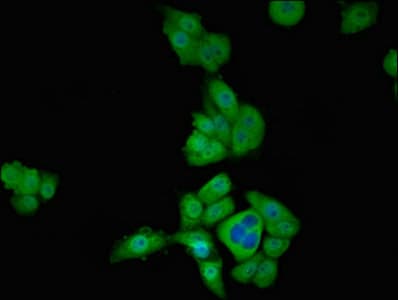 Polyclonal Rabbit anti-Human TBX1 Antibody (IF)