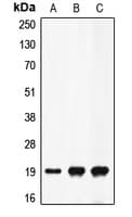 F2 / Prothrombin / Thrombin Antibody (Internal)