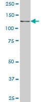 Monoclonal Mouse anti-Human CTNND2 / Delta-2 Catenin Antibody (clone 6E11, WB)