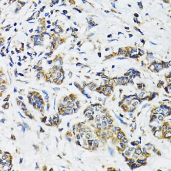 PathPlus™ SSBP1 / mtSSB Antibody