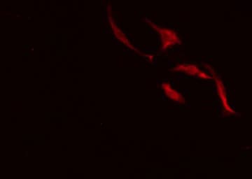 RPTN / Repetin Antibody (aa660-684)