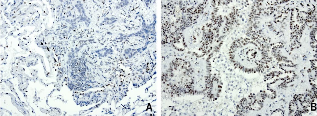 FOXP1 Antibody (clone UMAB89)