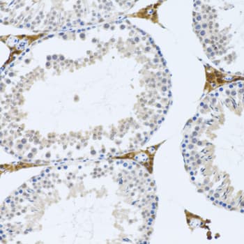 Polyclonal Rabbit anti-Human FMOD / Fibromodulin Antibody (IHC, WB)