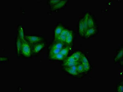 IHC-plus™ Polyclonal Rabbit anti-Human HMOX1 / HO-1 Antibody (aa3-288, IHC)