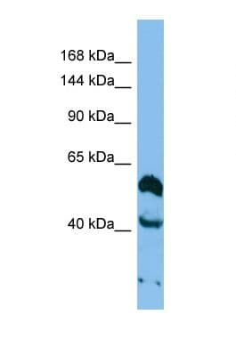 Polyclonal Rabbit anti-Human THSD1 / TMTSP Antibody (aa197-246, WB)
