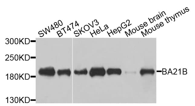 BAZ1B / WSTF Antibody