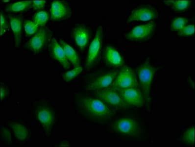 Polyclonal Rabbit anti-Human WWOX Antibody (IHC, WB)