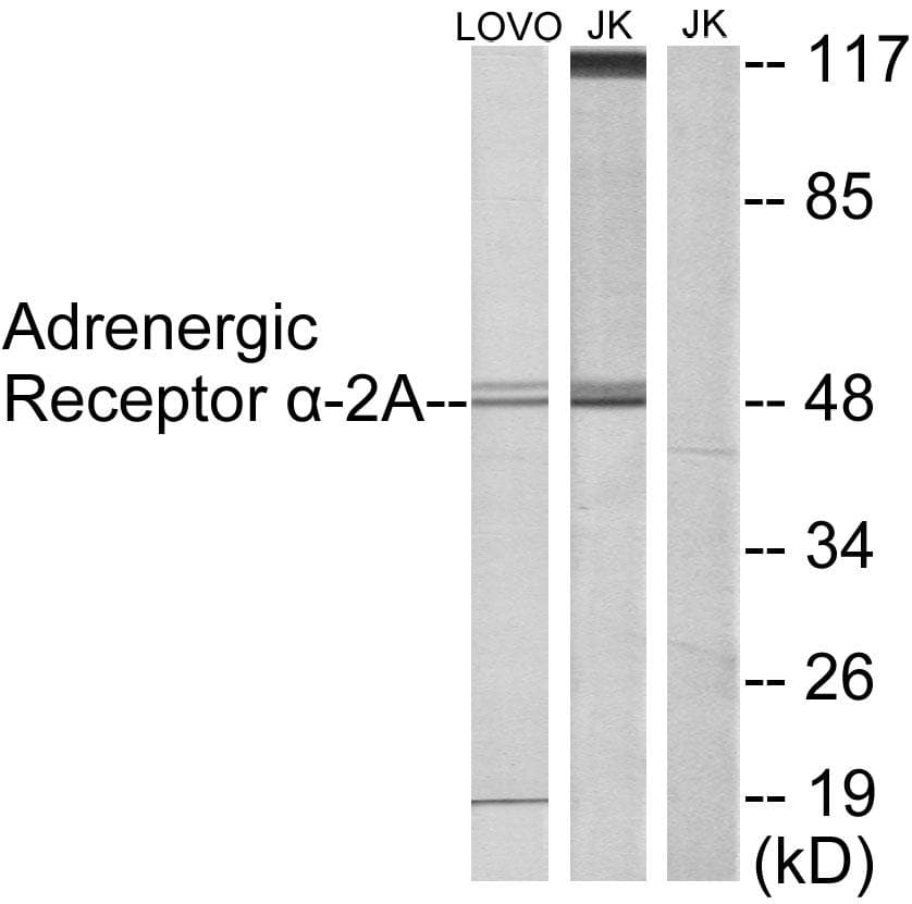Polyclonal Rabbit anti-Human ADRA2A Antibody (IHC, IF, WB)
