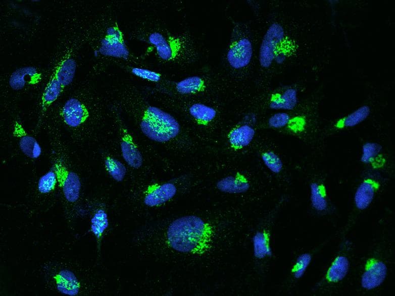 YIPF4 Antibody