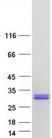 Human CT45A5 Protein (Recombinant Myc-DDK (Flag))