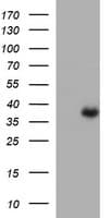 ARG2 / Arginase 2 Antibody (clone OTI1F6)