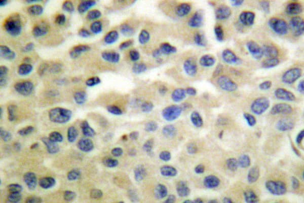 IKK Alpha+Beta Antibody (Gln174)