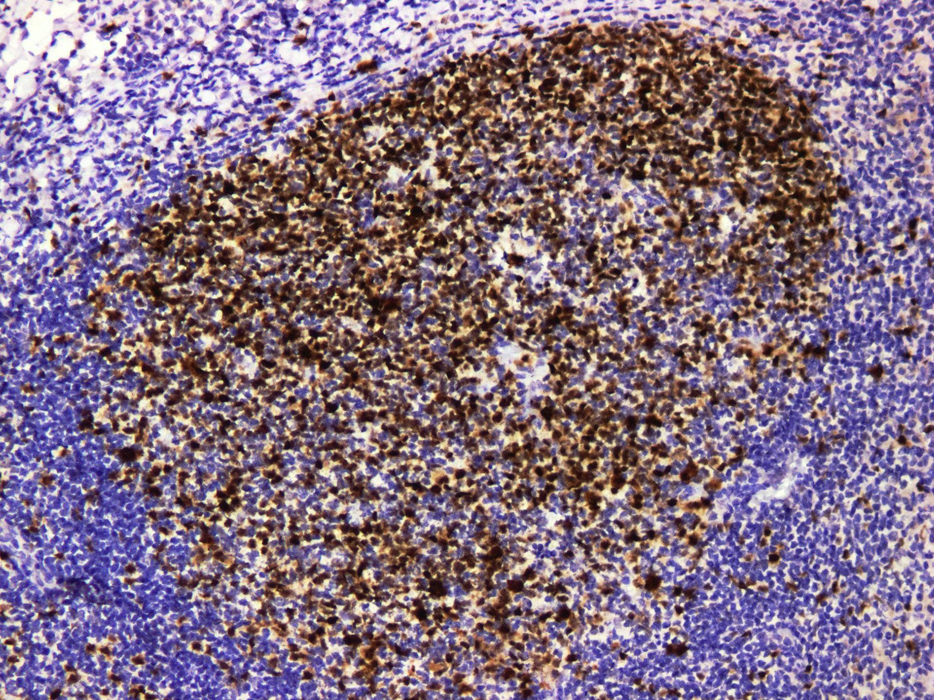 TOP2A / Topoisomerase II Alpha Antibody