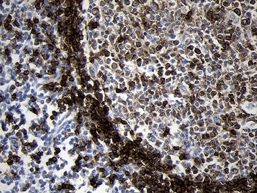 CD79B / CD79 Beta Antibody (clone OTI4E11)