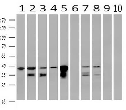 Monoclonal Mouse anti-Human UBXN2B Antibody (clone OTI3H8, WB)