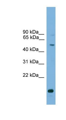 AUTL1 / ATG4C Antibody (aa175-224)