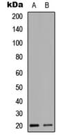 Polyclonal Rabbit anti-Human HEN1 + HEN2 Antibody (Internal, IHC, IF, WB)