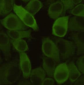 HSPB1 / HSP27 Antibody
