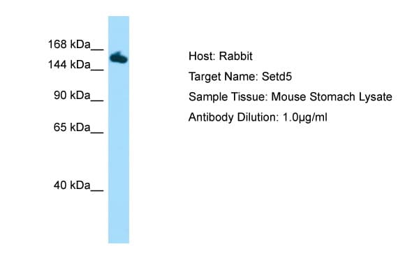 SETD5 Antibody (aa1201-1250, HRP)