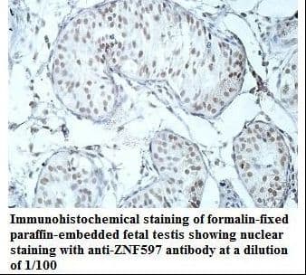 ZNF597 Antibody (aa10-240)