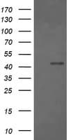 IHC-plus™ FCGR1A / CD64 Antibody (clone OTI1A8)