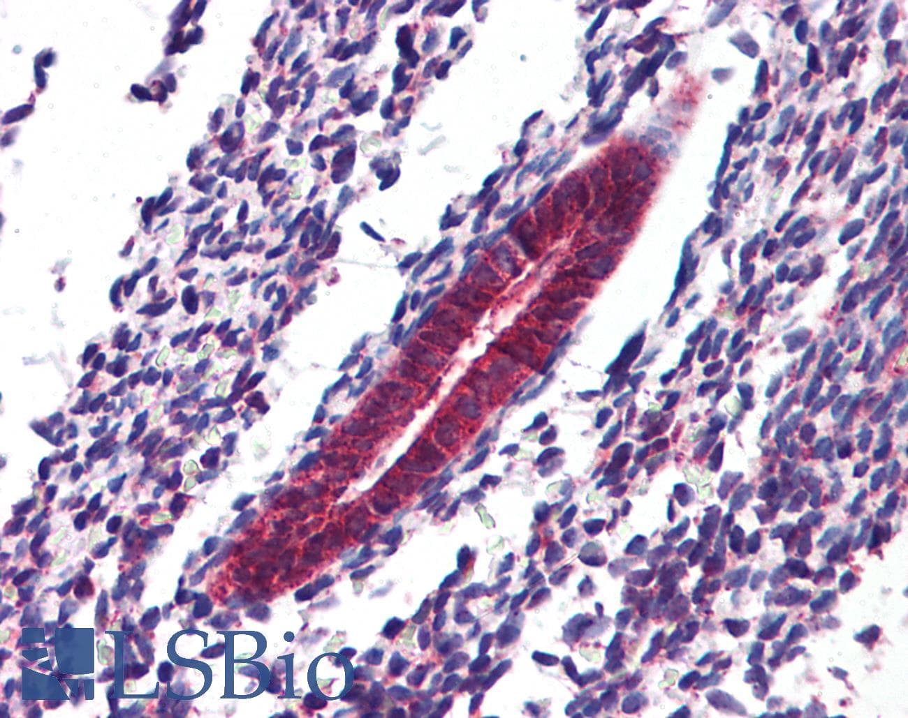 IHC-plus™ SRPX2 Antibody