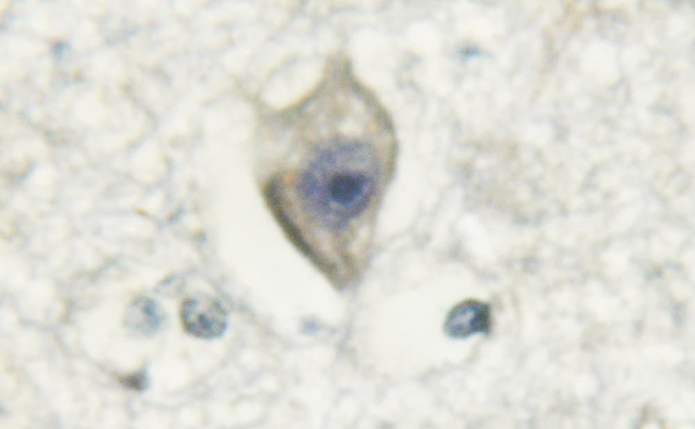 CALM3 / Calmodulin 3 Antibody