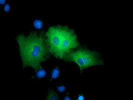 Monoclonal Mouse anti-Human ARHGAP25 Antibody (clone OTI4D8, IF, WB)