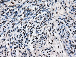 LEMD3 / MAN1 Antibody (clone OTI4E1, Carrier-free)
